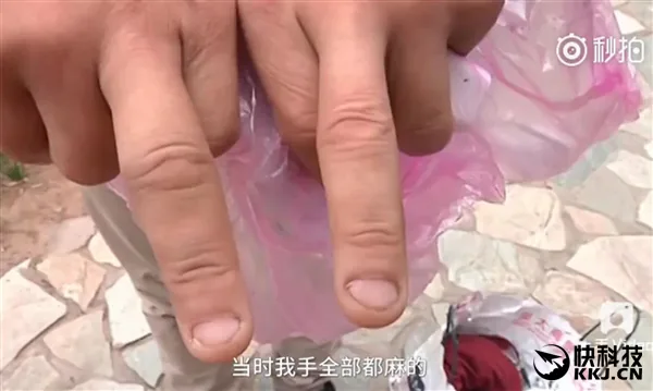 iPhone 7 phát nổ ngay trước mặt khi đang quay video