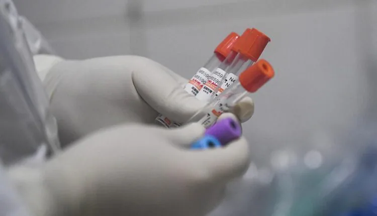 Siêu máy tính đã phát hiện được 77 loại thuốc có thể giảm lây lan virus Corona