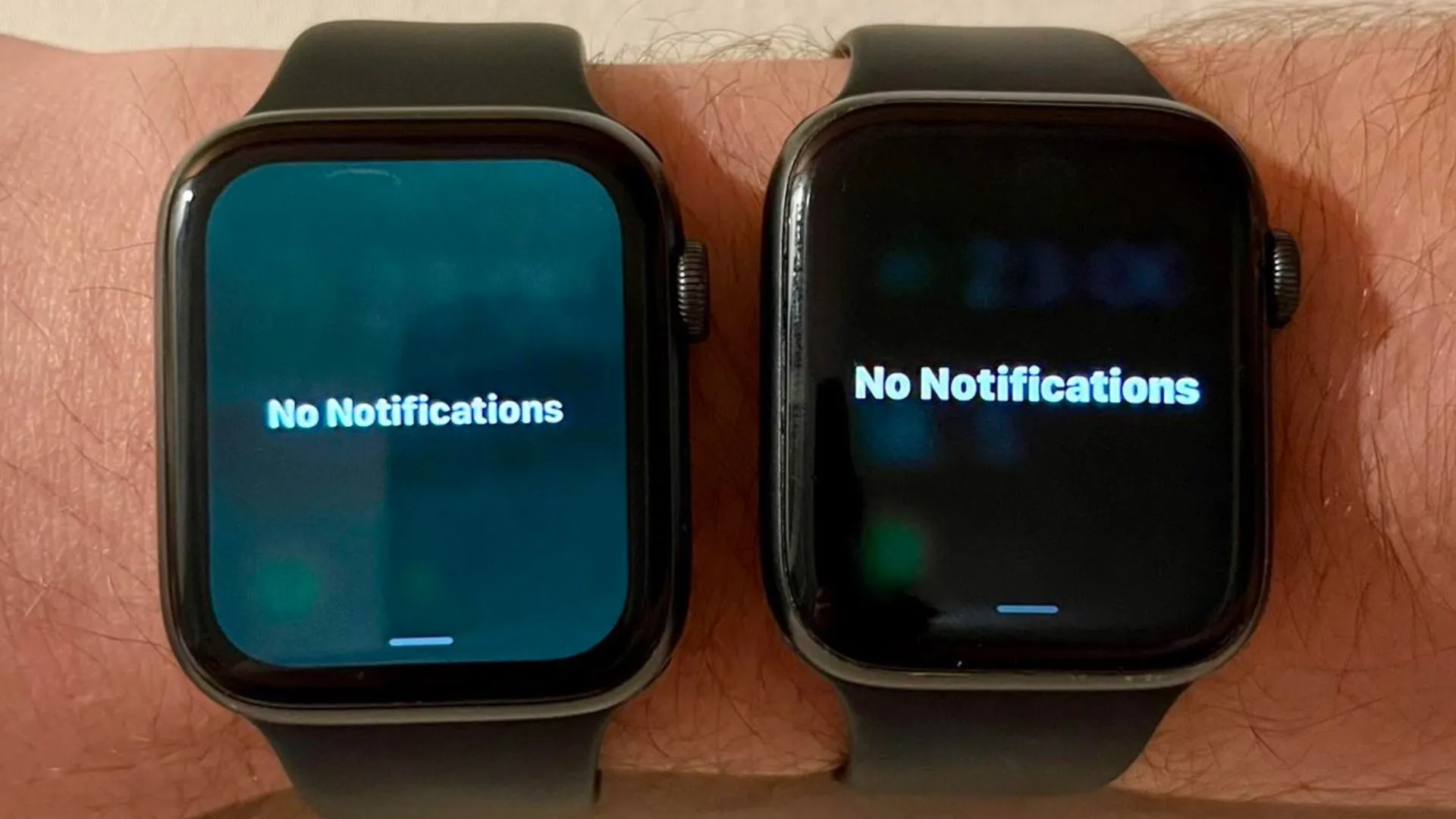 Apple Watch gặp lỗi màn hình ám xanh khi cập nhật watchOS 9.5