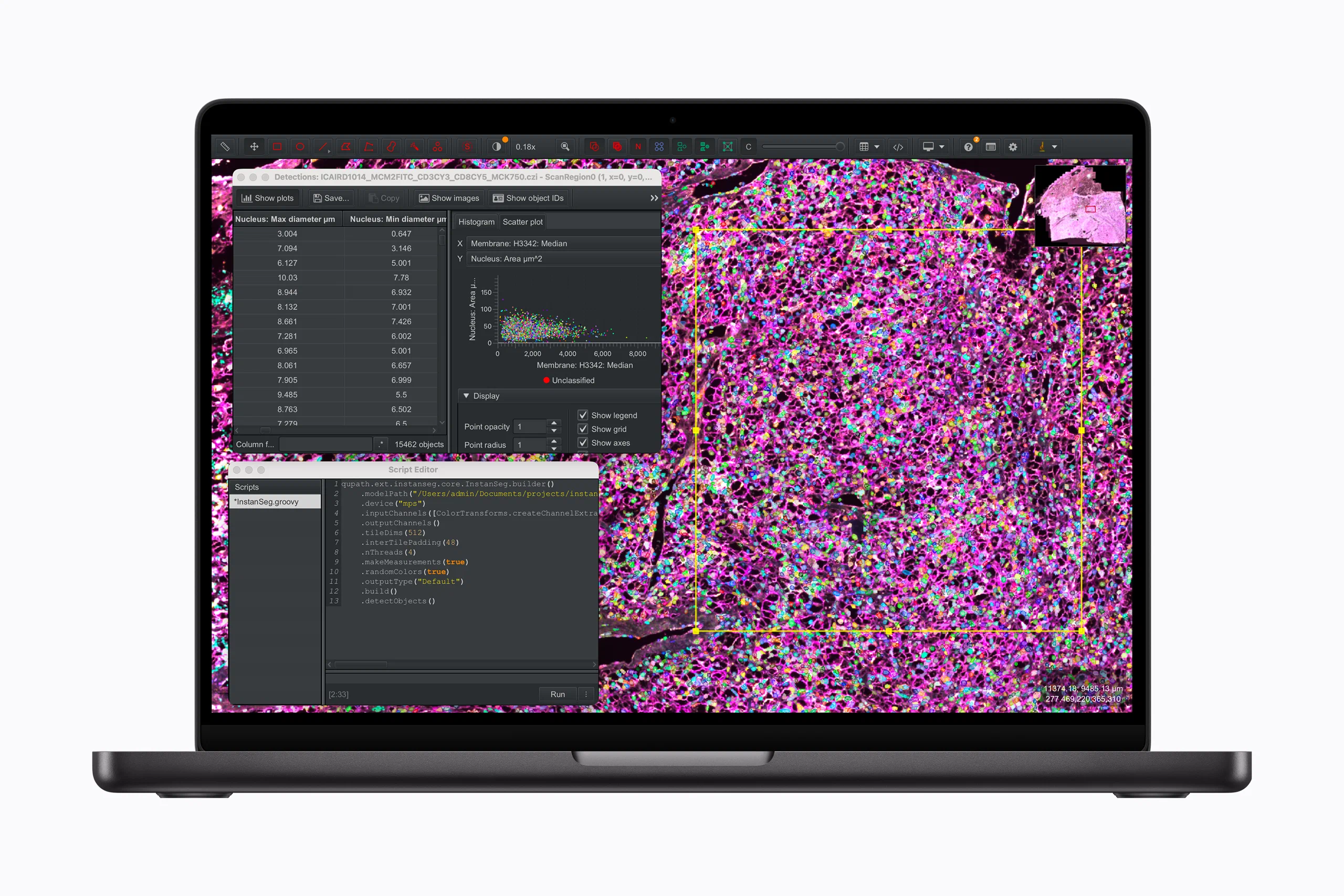 Apple ra mắt MacBook Pro M5 Pro và M5 Max: AI nhanh gấp 4 lần, SSD đạt 14.5GB/s, khởi điểm 59.9 triệu đồng